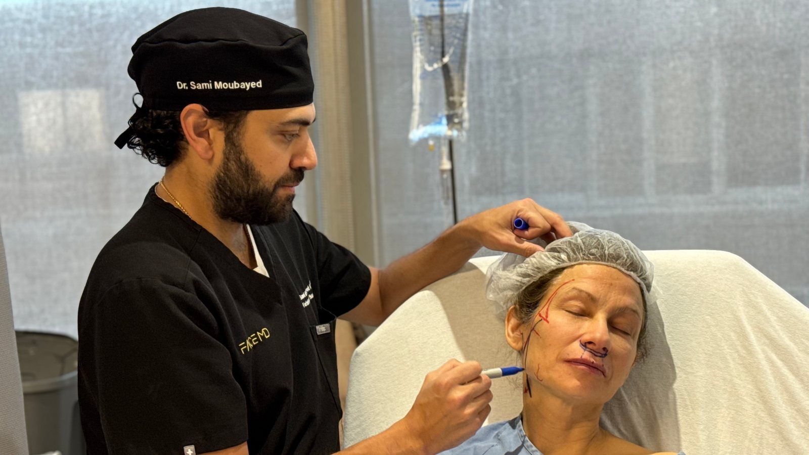 Deep plane facelift: the details that refine the result